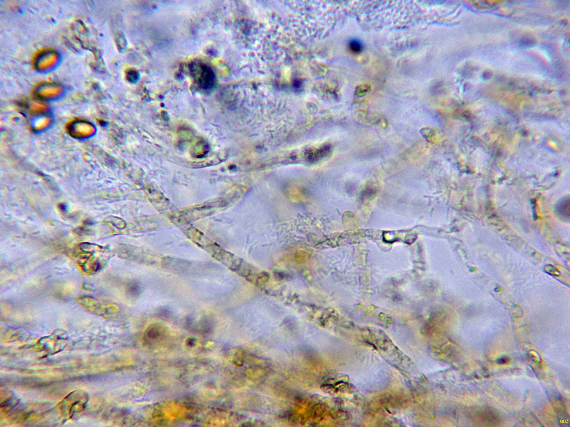 Microscopía de Pholiota carbonaria - 10 - Suprapellis-003